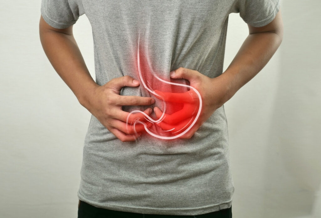 Laparoscopic Fundoplication for Acid Reflux: Is It the Right Option for You?